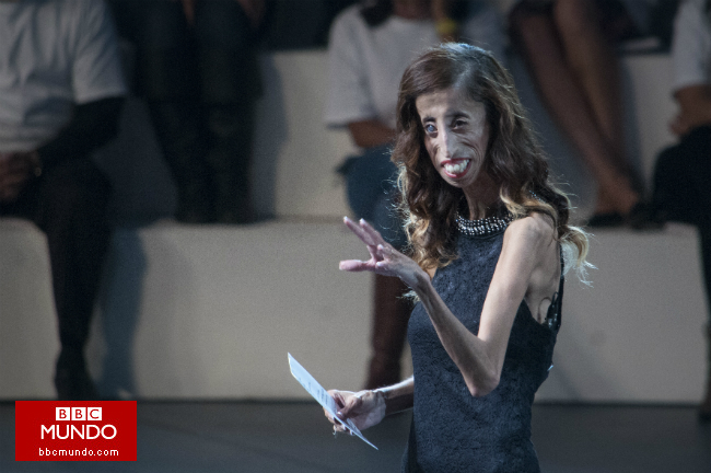 La inspiradora historia de superación de Lizzie Velásquez, “la mujer más fea del mundo”