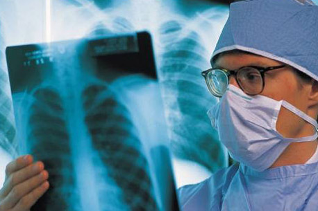 En México, 85% de los pacientes con fibrosis quística muere sin diagnóstico