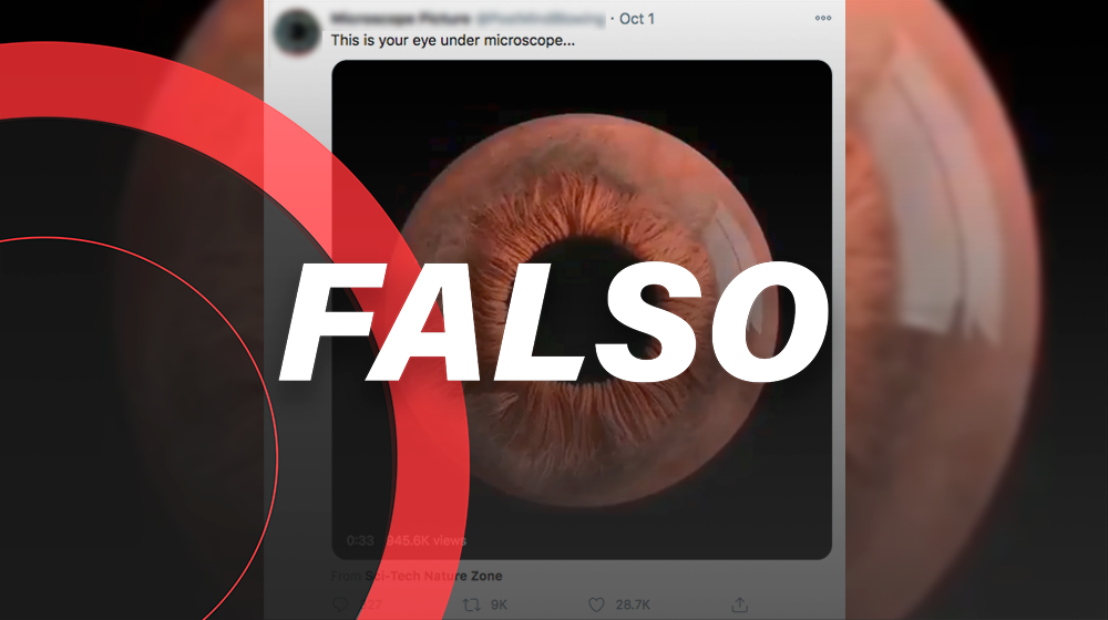 Noup, *así no se ven tus ojitos bajo el microscopio*: ¿entonces cómo?