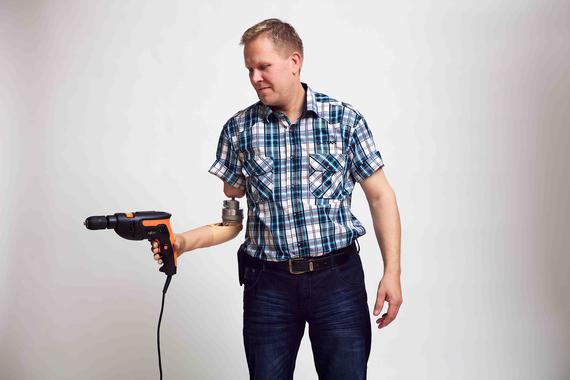 Manos y brazos biónicos devuelven el tacto a amputados