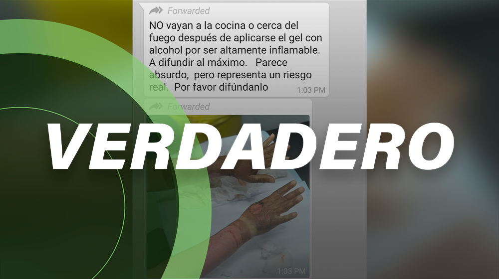 Es neta: *El gel antibacterial sí puede causar quemaduras* (¡pero calma! Así te proteges)