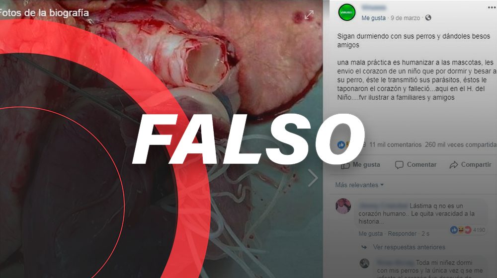 Es falso que el corazón de un niño se llenó de gusanos por dormir con su...