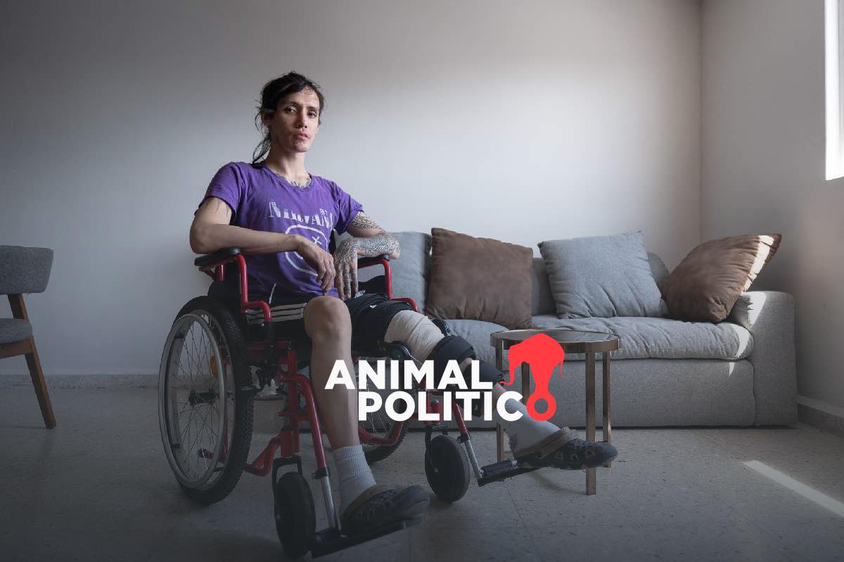 Genn contrató Uber Moto: se accidentó, el conductor huyó, la app no responde y aún no puede caminar