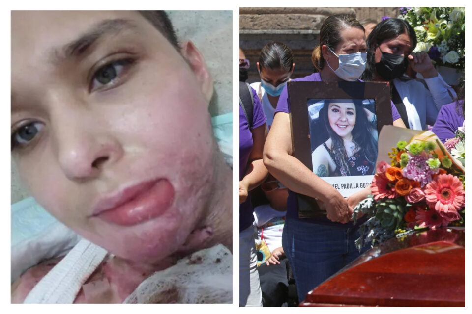 Casos de Liliana y Luz Raquel exhiben criminalización a víctimas de quemaduras