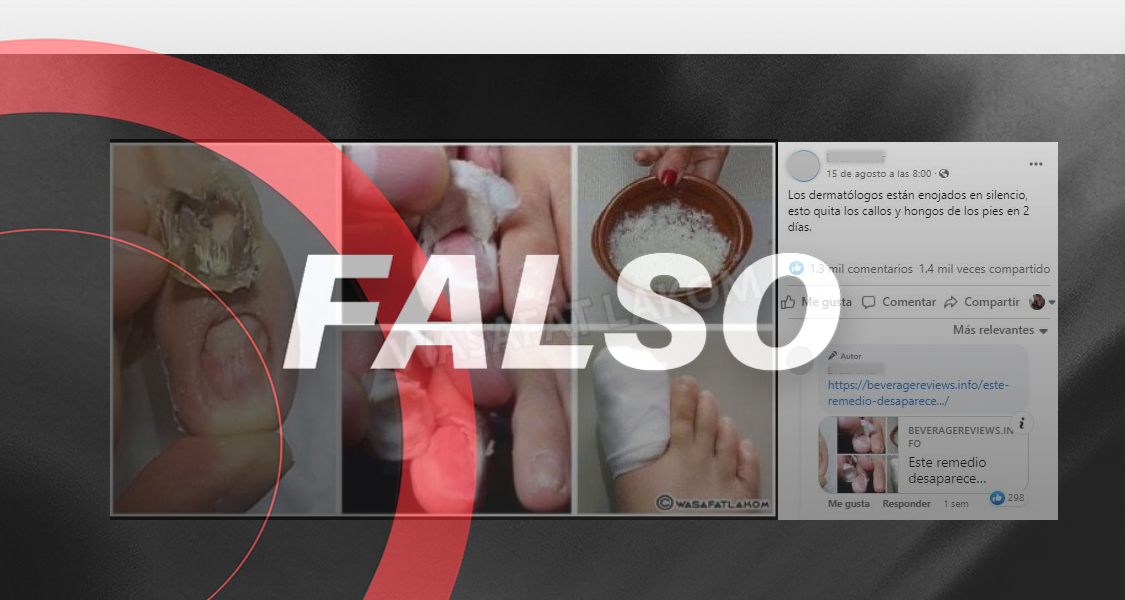 Untar una mezcla de ajo, limón y romero no quita los hongos en uñas de los...