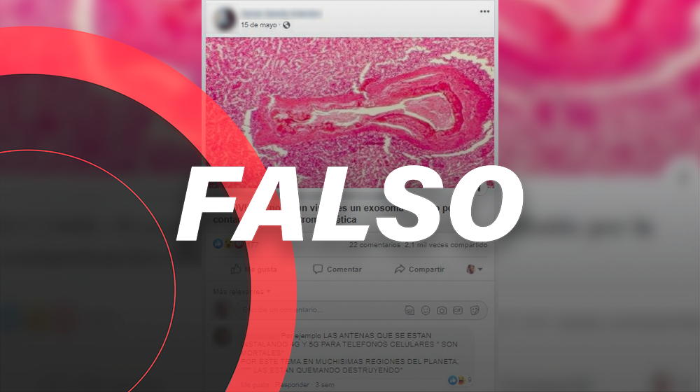 La COVID-19 es un virus, no un exosoma que se activa con red 5G