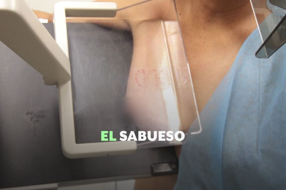 Especialistas recomiendan mastografías después de los 40 años y otras medidas de detección