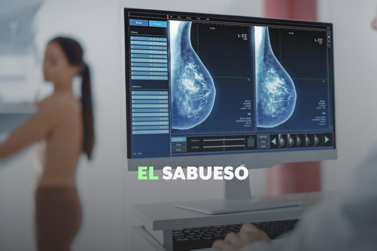 Cuando la desinformación enferma: 14 ideas erróneas sobre el cáncer de mama