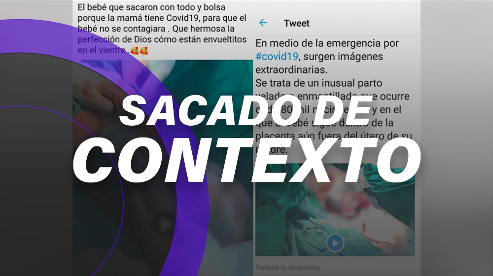 Este bebé no nació dentro del saco amniótico porque su mamá tenía *COVID-19*