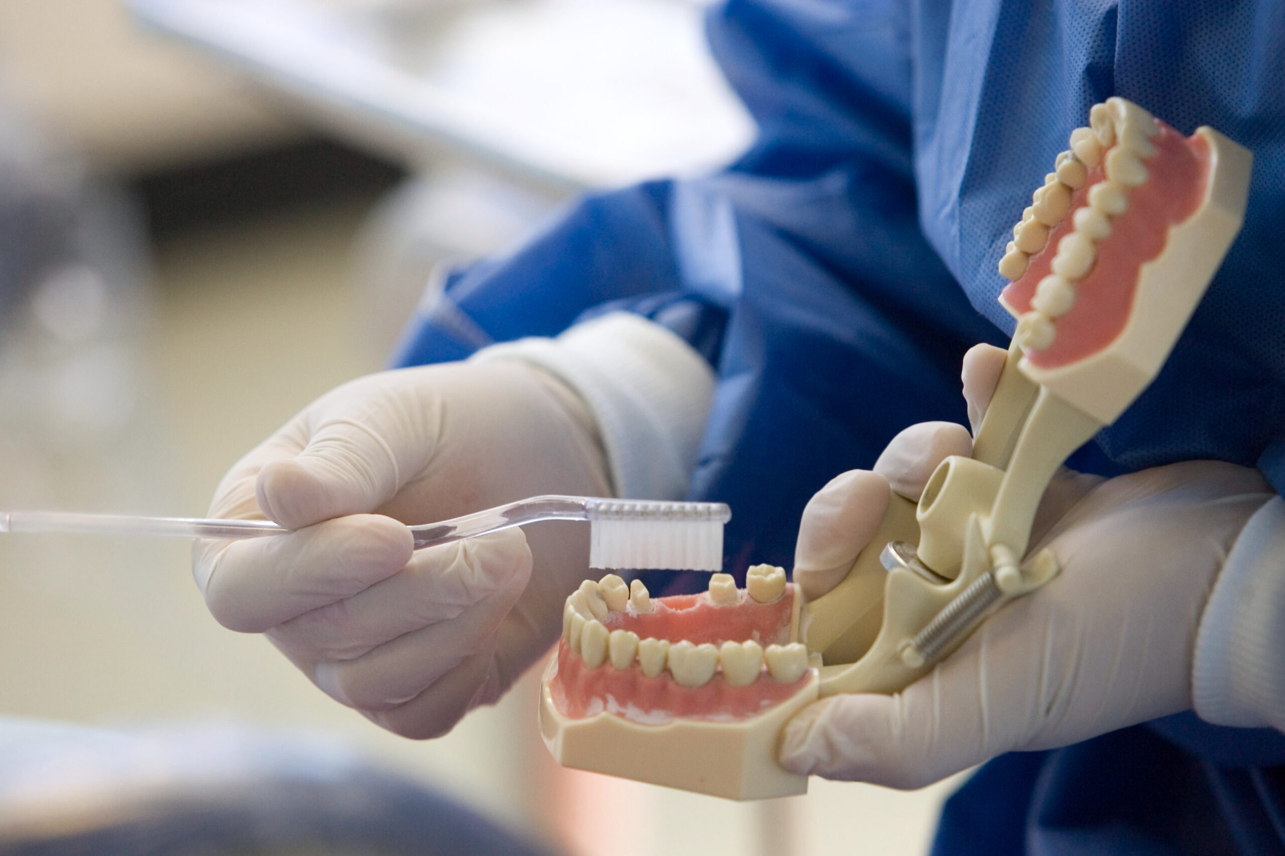 Cáncer de boca; por qué dejar de lavarse los dientes te genera más riesgo que el tabaco