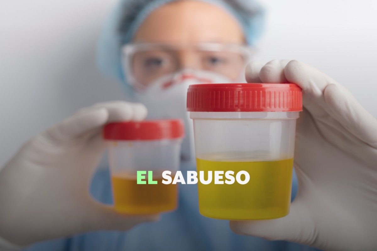 El color de la orina: lo que tu cuerpo quiere decirte