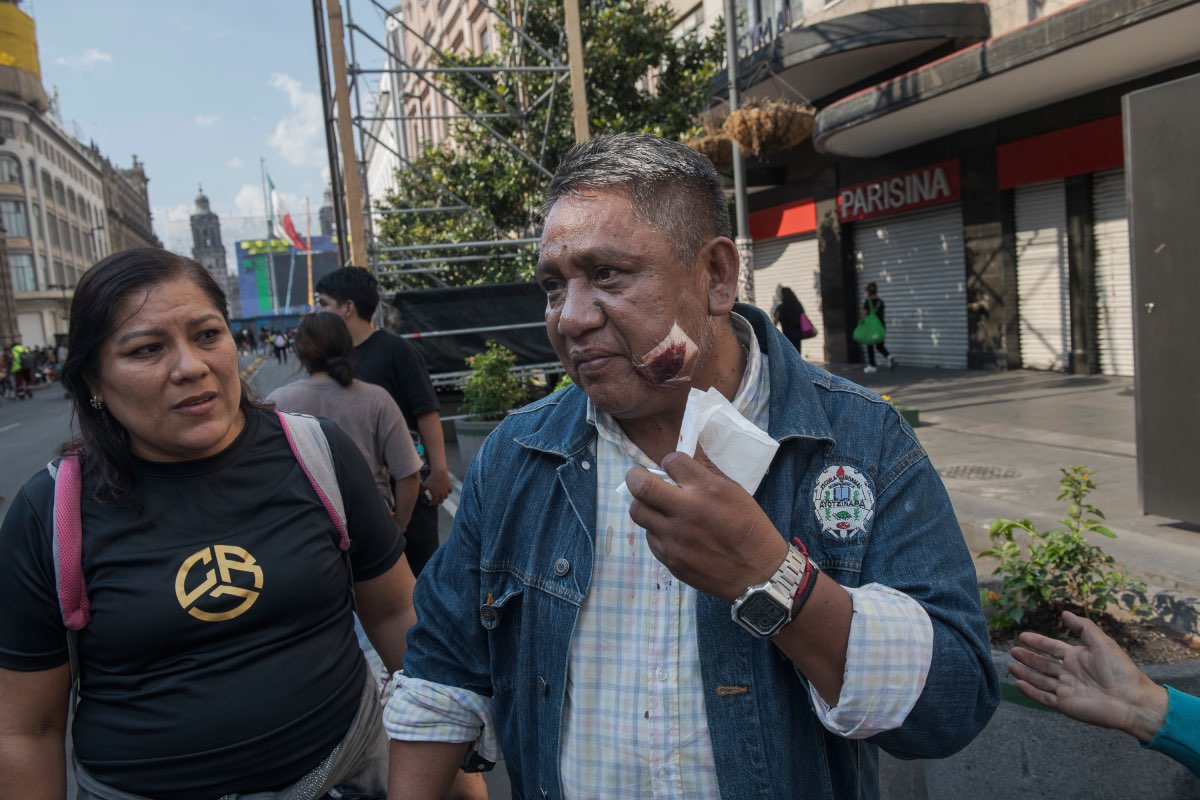 Octavio Romero Jerónimo resultó herido en el rostro