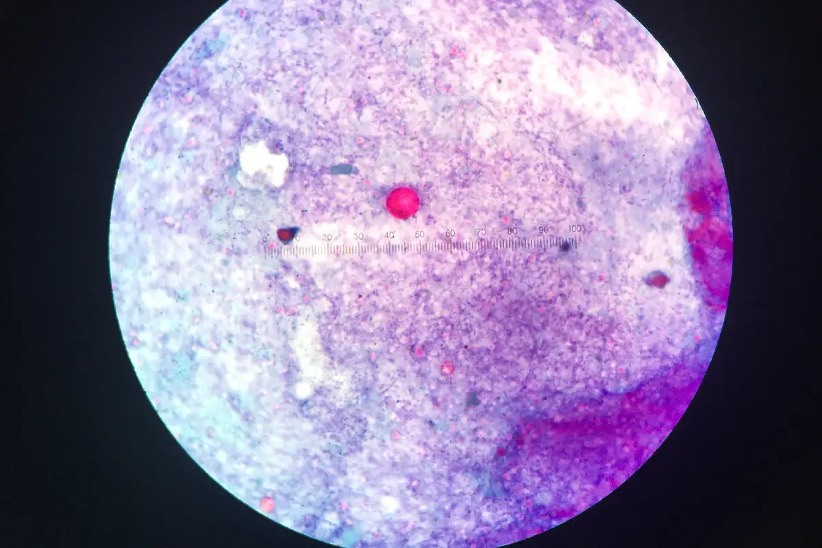 toma microscópica de ciclosporiasis