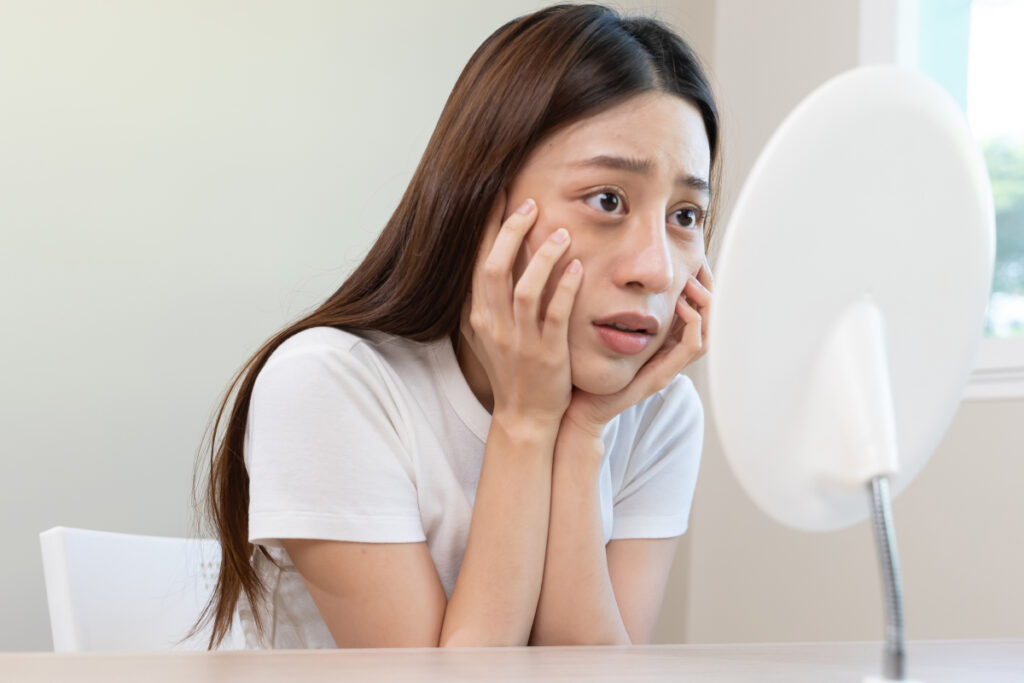 Las ojeras suelen ser las primeras en aparecer cuando le hace falta al cuerpo horas de sueño. (Fuente: Adobe Stock)