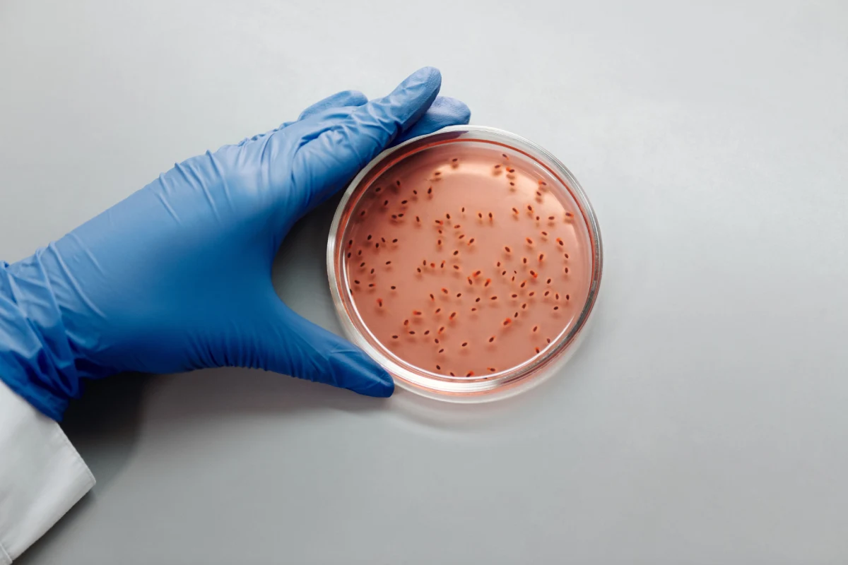 Salmonella hospital general